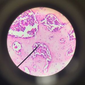 Meet your Posher, Nick